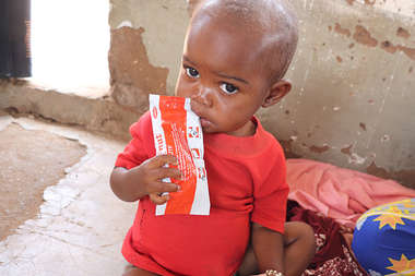 Kind in Kongo erhält Zusatznahrung